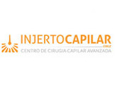 Injerto Capilar