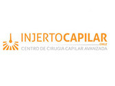 Injerto Capilar