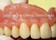 Laboratorio DentoSmile