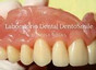 Laboratorio DentoSmile