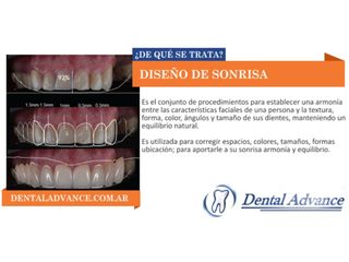 dental advance publicacion  47