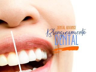 blanqueamiento Dental Advance 