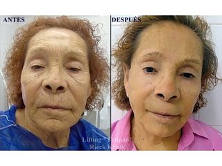 Rieck Klinik Medical Spa