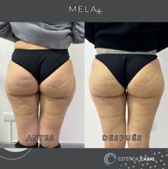 Mela - Estetica Casal