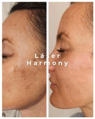 Manchas en la piel - Medvital