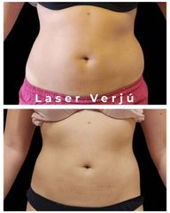 Tratamiento Corporal - Medvital
