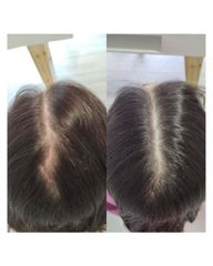 Plasma Capilar - Medvital