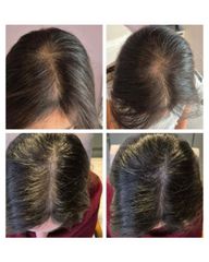 Plasma Capilar - Medvital