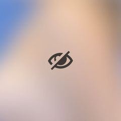 Lipoaspiración de abdomen, cintura y dorso con marcación y lipotransferencia glutea