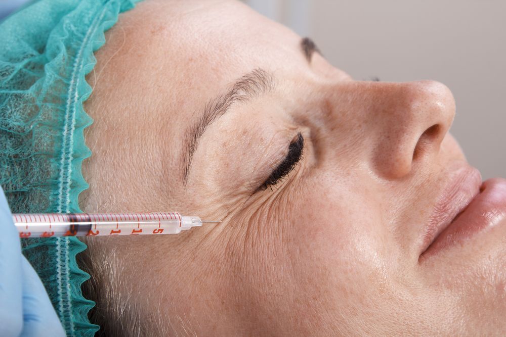 mujer recibiendo una inyección de bótox en las arrugas