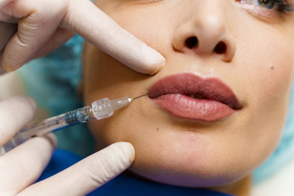 Mujer recibe inyección de ácido hialurónico en sus labios