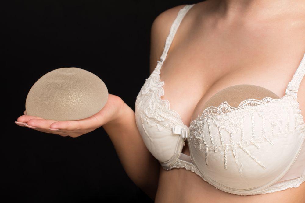 mujer sosteniendo un implante mamario