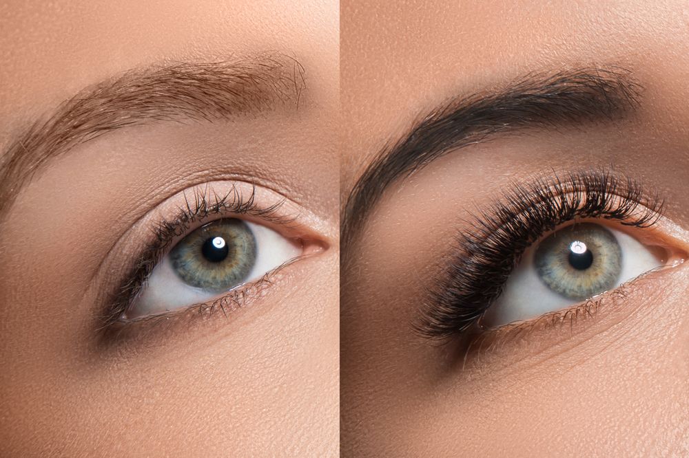 antes y después de un tratamiento en las cejas