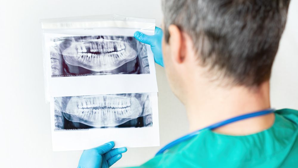 médico revisa radiografías dentales