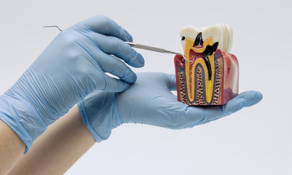 Endodoncia