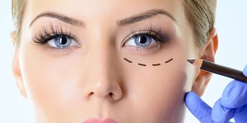 Dr. Renán Pereira: Blefaroplastia para jóvenes