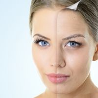 Conoce los 5 láseres para el rejuvenecimiento facial