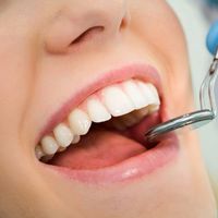 Los 5 pasos de una endodoncia
