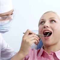Los 5 pasos de una limpieza dental