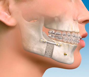 Todos los avances de la cirugía maxilofacial