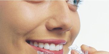 Dientes perfectos, el secreto de los famosos