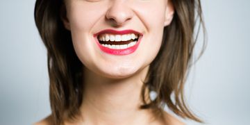 Los implantes dentales y la regeneración ósea