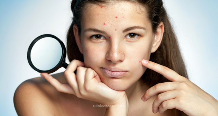 ​ClearLight tecnología inigualable contra el acné