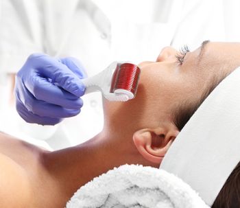 Microneedling: nueva terapia para estimulación cutánea