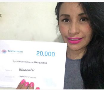 Conoce a Blanca20 la ganadora del sorteo de Clinicasesteticas