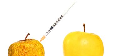 ¿Toxina butolinica ácido hialurónico? La gran confusión.