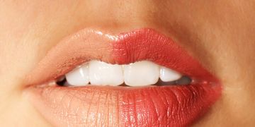 ​Permalip: labios con volumen permanente