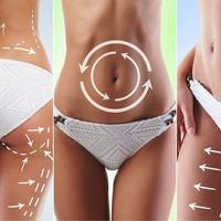 ​Esculpe tu cuerpo con la liposucción