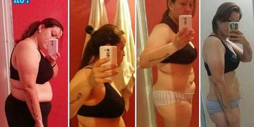 Descubre la lipoplastia y dile adios a la grasa