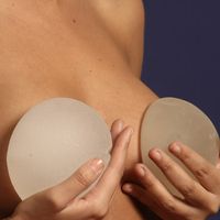 4 mitos sobre los implantes mamarios que debes dejar de creer