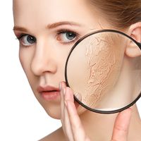 Técnicas para evitar la resequedad después de un tratamiento para el acné