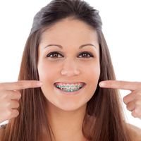 Tipos de ortodoncia: ¿cuál tratamiento necesito?