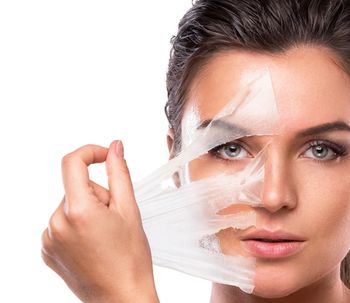 Una piel más brillante gracias al peeling de ácido Tricloroacético.