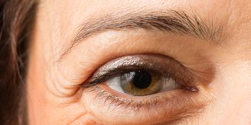 La lucha contra las ojeras y bolsas en los ojos