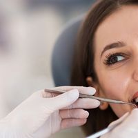Importancia de la higiene bucal luego de una extracción dental