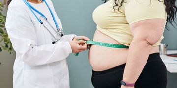 Cambio interno, cambio externo: Cirugías para tratar la obesidad