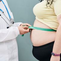 Cambio interno, cambio externo: Cirugías para tratar la obesidad
