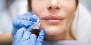 Resuelve las dudas más frecuentes sobre la hialuronidasa