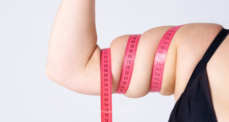 El mejor tratamiento para combatir el lipedema