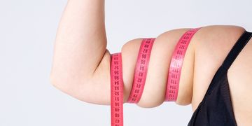 El mejor tratamiento para combatir el lipedema