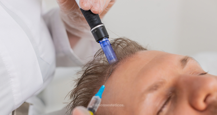 Bioestimulación capilar con péptidos y exosomas