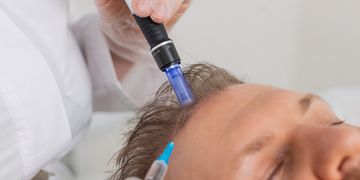 Bioestimulación capilar con péptidos y exosomas Bioestimulación capilar con péptidos y exosomas