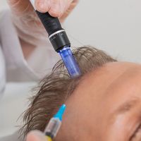 Bioestimulación capilar con péptidos y exosomas