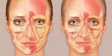 Adipoestructuración facial: bioestimulación profunda para un rejuvenecimiento natural Adipoestructuración facial: bioestimulación profunda para un rejuvenecimiento natural