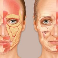 Adipoestructuración facial: bioestimulación profunda para un rejuvenecimiento natural