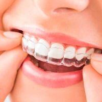Ortodoncia Invisible: La Revolución Estética y Digital que Está Transformando las Sonrisas